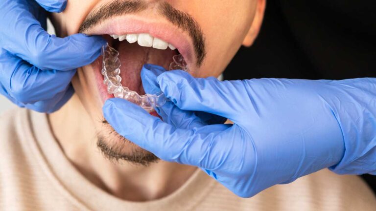 orthodontic-specialist-adjusting-invisible-aligner-2023-11-27-05-27-05-utc