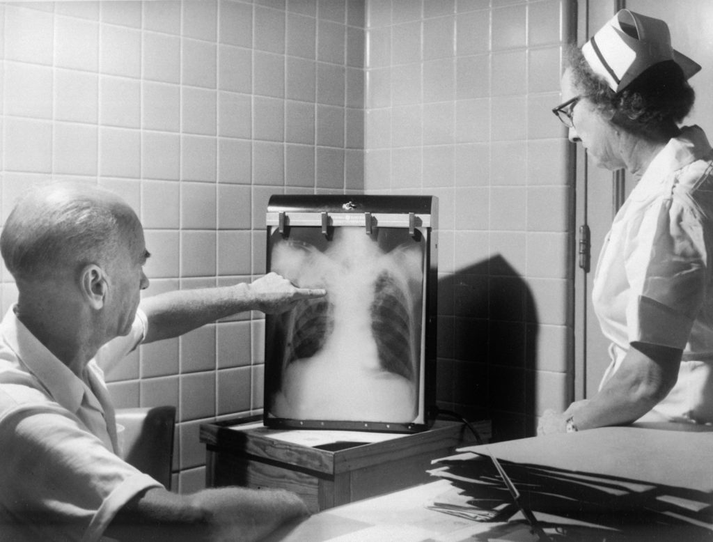 Doctors examining a chest X-ray for respiratory disease